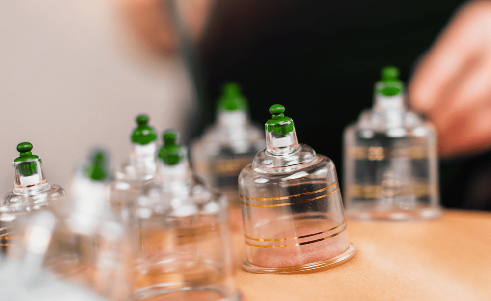 Cupping Therapy